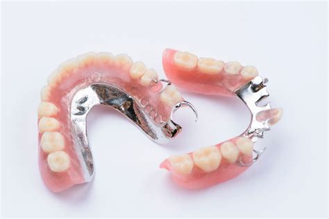 How to Repair Partial Dentures at Home: A Comprehensive Guide